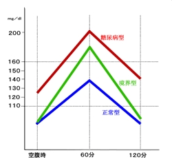 ７５ｇ糖負荷試験